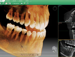 Software 3D Ez3D-i